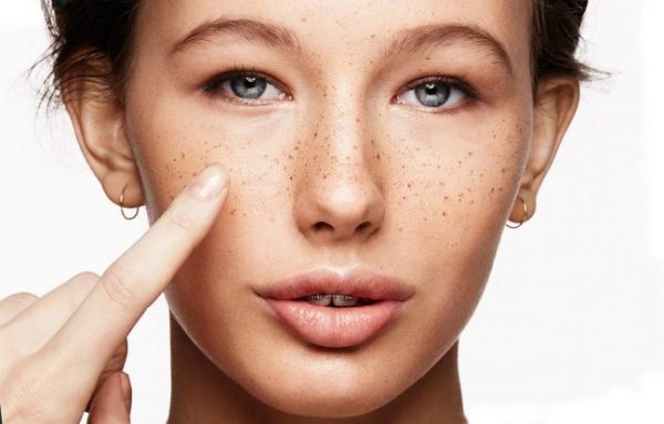 Основні причини появи пігментних плям